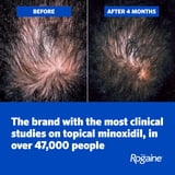 Men's Rogaine 5% Minoxidil Solution 3x 2 Fl oz