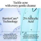 Neutrogena Oil-Free Acne Face Wash, Fragrance Free, 2% Salicylic Acid, 9.1 fl oz