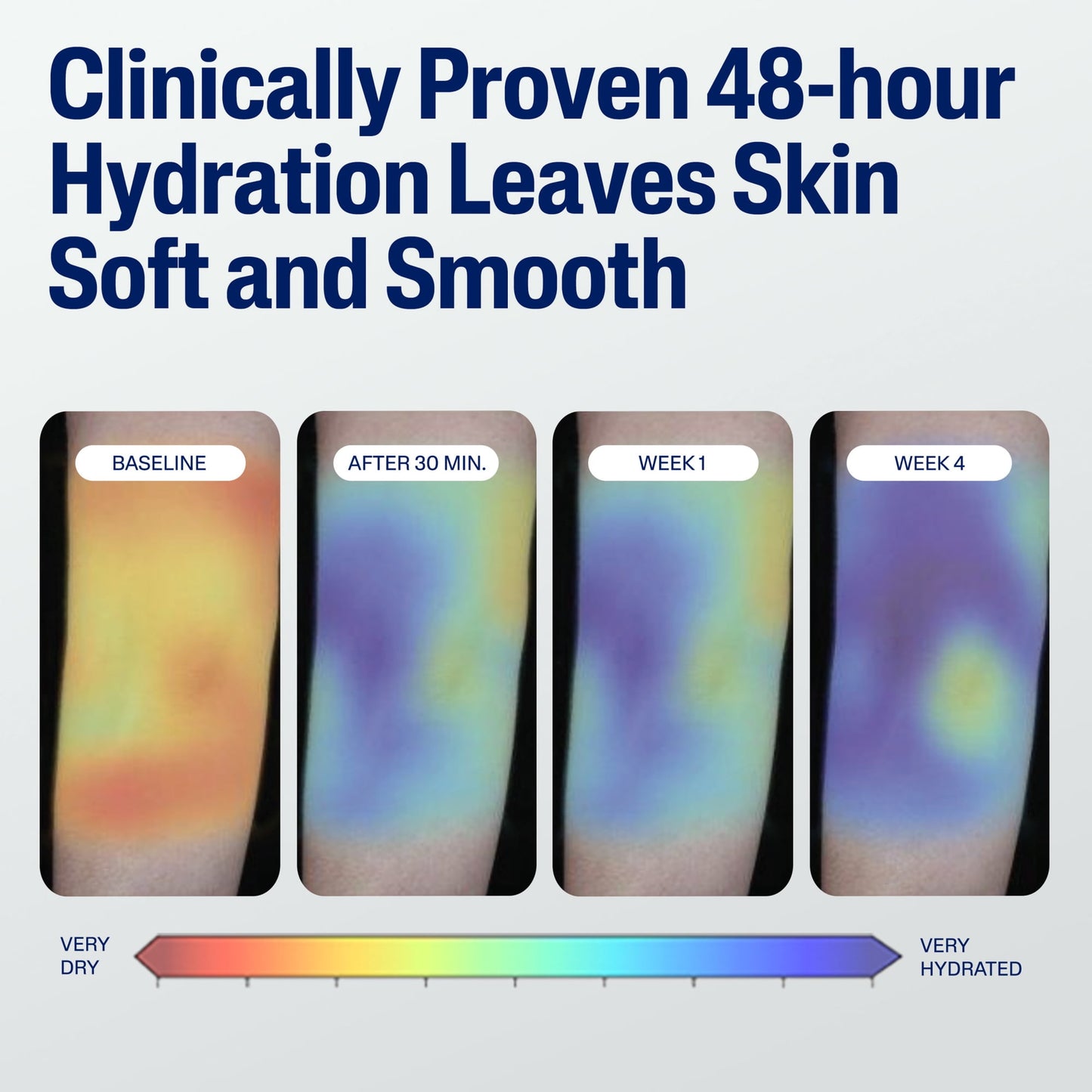 (3 pack) Cetaphil Hydrating Moisturizing Lotion for Normal to Dry Skin, Sensitive Skin, 33.8 Fl Oz