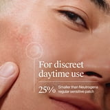 Neutrogena Sensitive Skin Pimple Patches, Hydrocolloid Patches, Acne Treatment, 2 Sizes, 80 Count