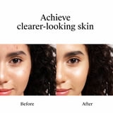 Neutrogena Rapid Clear Acne Spot Treatment, Benzoyl Peroxide 10% Pimple Cream, 1 oz