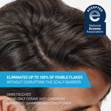 CeraVe Hydrating Anti-Dandruff Conditioner for Flakey Itchy Scalp 9 fl oz