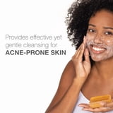 (2 pack) Neutrogena Acne Face Wash Bar, Acne Treatment for Acne-Prone Skin, Facial Cleanser, 3.5 oz
