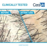 CeraVe Hydrating Anti-Dandruff Conditioner for Flakey Itchy Scalp 9 fl oz