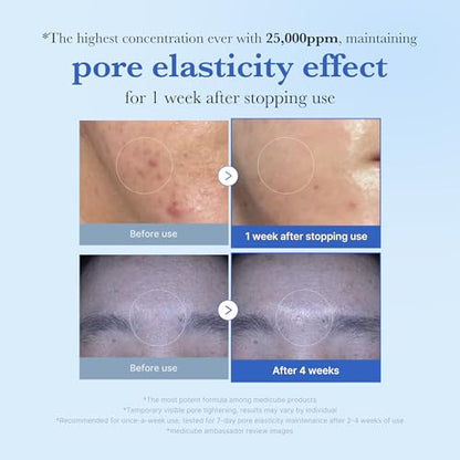 medicube Exosome Shot Zero 25,000PPM Spicule Facial Serum For Pores & Sebum