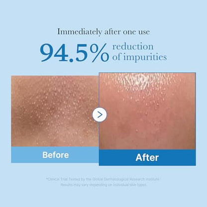 medicube Double Cleansing Duo - Zero Pore Cleansing Oil, Zero Foam Cleanser