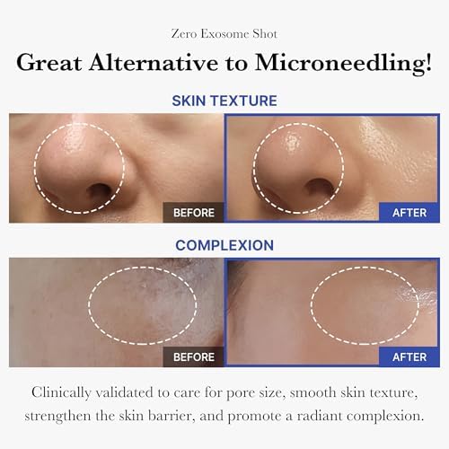 medicube Zero Pore Set - Zero Pore Pads & Exosome Shot 2,000 Spicule Serum
