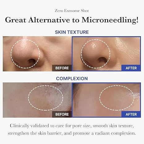 medicube Flawless Skin: Deep Vitamin C Golden Capsule Face Moisturizer and Zero Exosome Shot 7,500 PPM Spicule Facial Serum