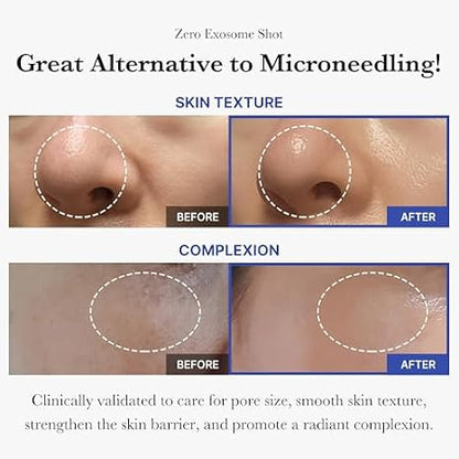 medicube Flawless Skin: Deep Vitamin C Golden Capsule Face Moisturizer and Zero Exosome Shot 7,500 PPM Spicule Facial Serum