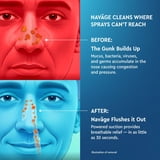 Navage Nasal Care Saline Nasal Irrigation Bundle