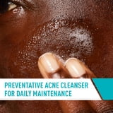 (2 pack) CeraVe Skin Care Acne Control Face Cleanser with 2% Salicylic Acid Clears Acne Blackheads Pores