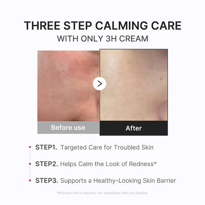 medicube Clear & Calm Skin Duo: Hypochlorous Acid Peel Shot and 3H Relief Cream | Gentle Exfoliating Serum for Dead Skin Cells and Calm with Daily Soothing Moisturizer | For Clearer, Smoother Skin