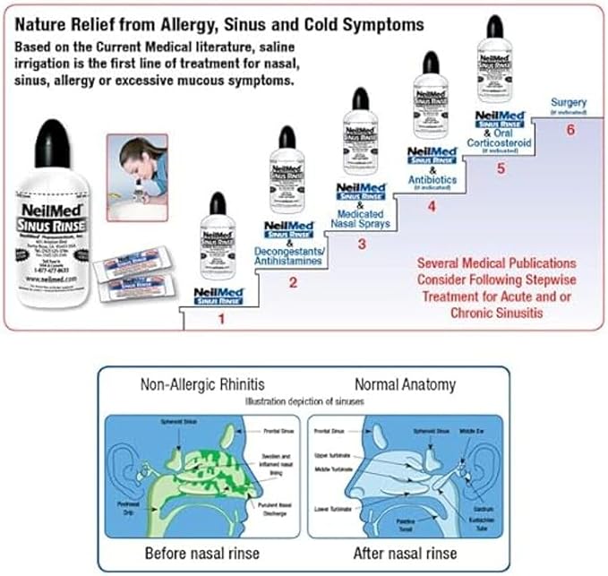 NeilMed Sinus Rinse All Natural Relief Premixed Refill Packets 100 Count (Pack of 1)