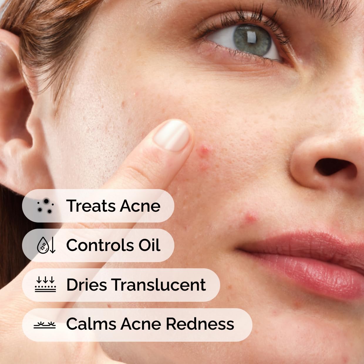 The Ordinary Sulfur 10% Powder-to-Cream Acne Spot Treatment Concentrate, Reduces Pimple Size and Zit Redness, 0.18 Oz (Pack of 2)