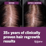 Women's Rogaine Hair Regrowth, 4 Mo, 2x 2.11 oz