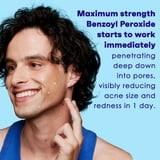 (2 pack) Clean & Clear Persa-Gel 10 Acne Treatment, Benzoyl Peroxide, 1 fl. oz