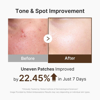 medicube Capsule Cream with Deep Vitamin C for Uneven Skin Tone & Texture