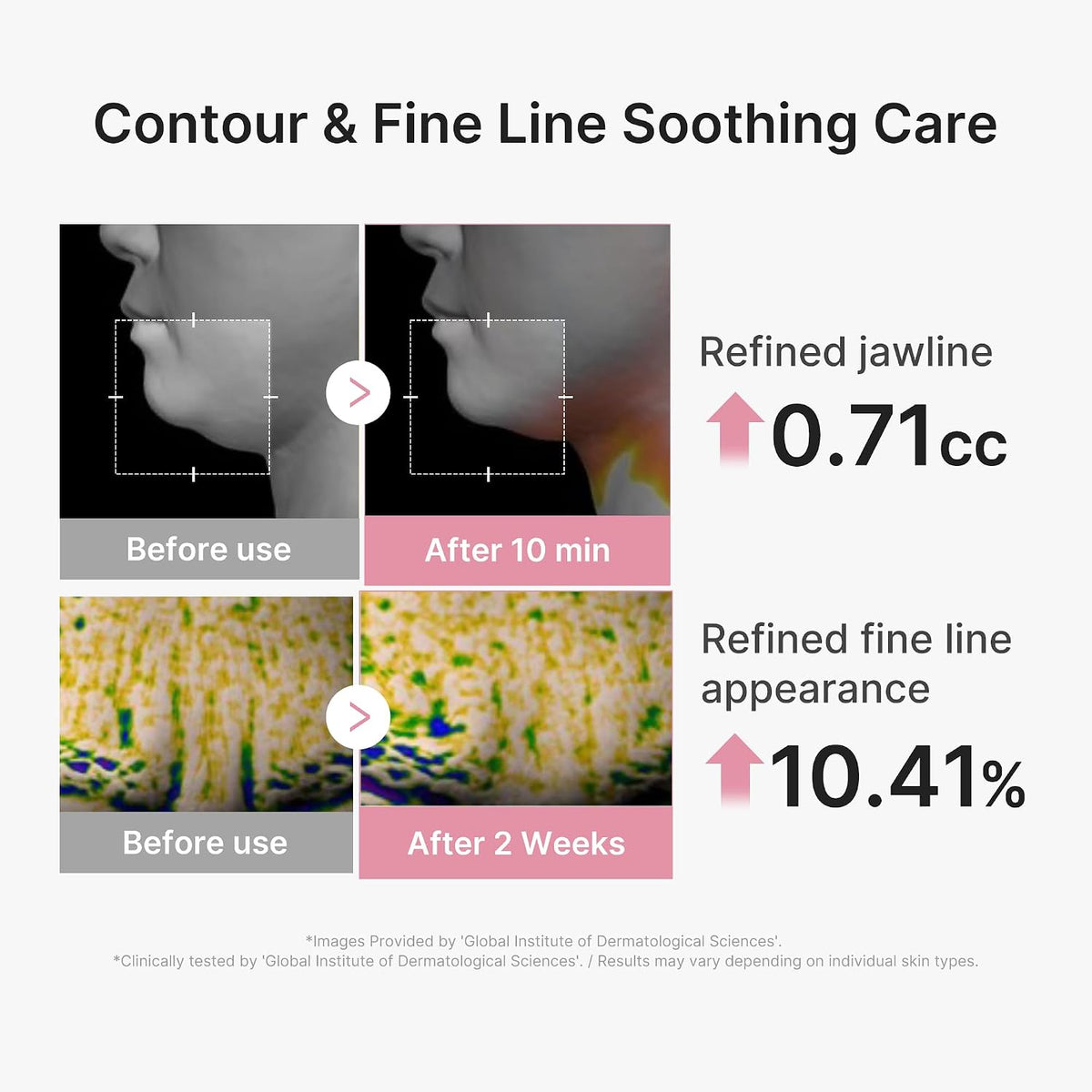 medicube PDRN Pink Tension Up Sheet Mask - 3-Step Contouring Mask