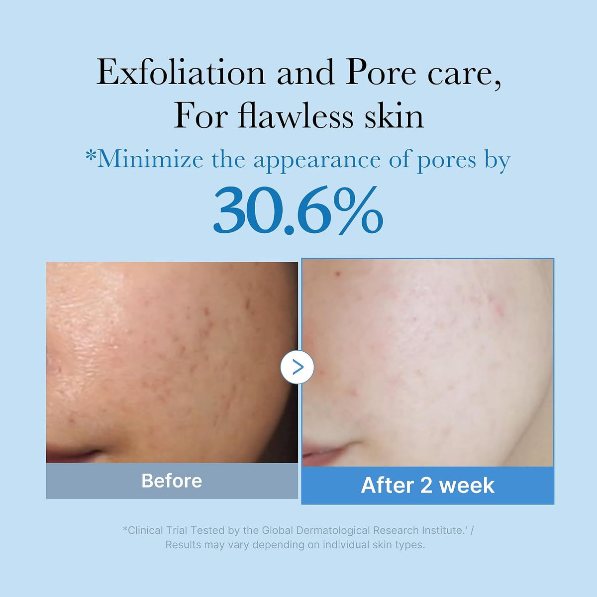 medicube Zero Pore Exfoliating & Hydrating Toner (Pack of 2)