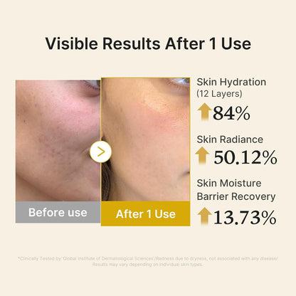 medicube Jelly Mist Serum with Kojic Acid Turmeric, Brightening Face Mist