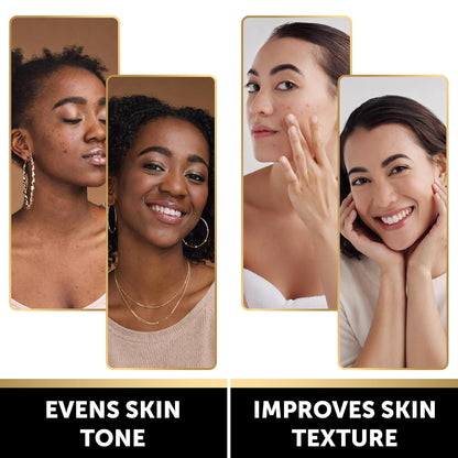 VALITIC Brightening Lemon Turmeric Kojic Acid Soap for Dark Spots, 2 Pack