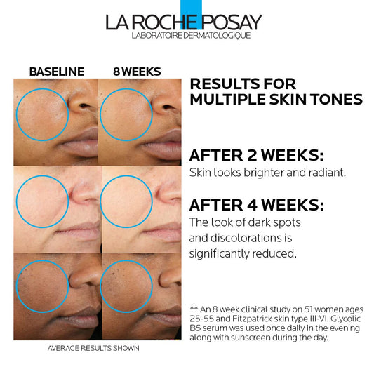 La Roche-Posay Glycolic Acid Dark Spot Serum with Vitamin B5, 1oz