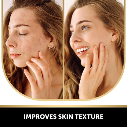 VALITIC Kojic Acid and Turmeric Soap for Dark Spots and African Net, 2 Pack