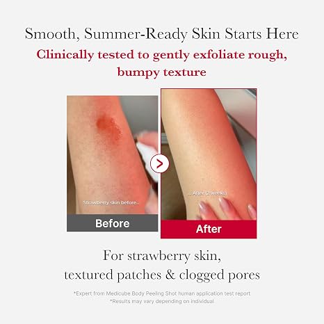 medicube Red Body Peeling Shot - AHA & BHA Exfoliating Body Spray, 3.88 oz