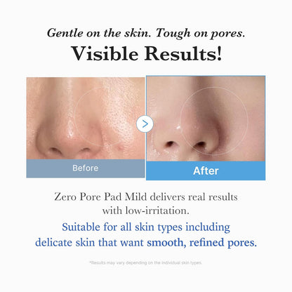 medicube Toner Pads Zero Pore Pad Mild 2.0, Gentle Exfoliation & Pore Care