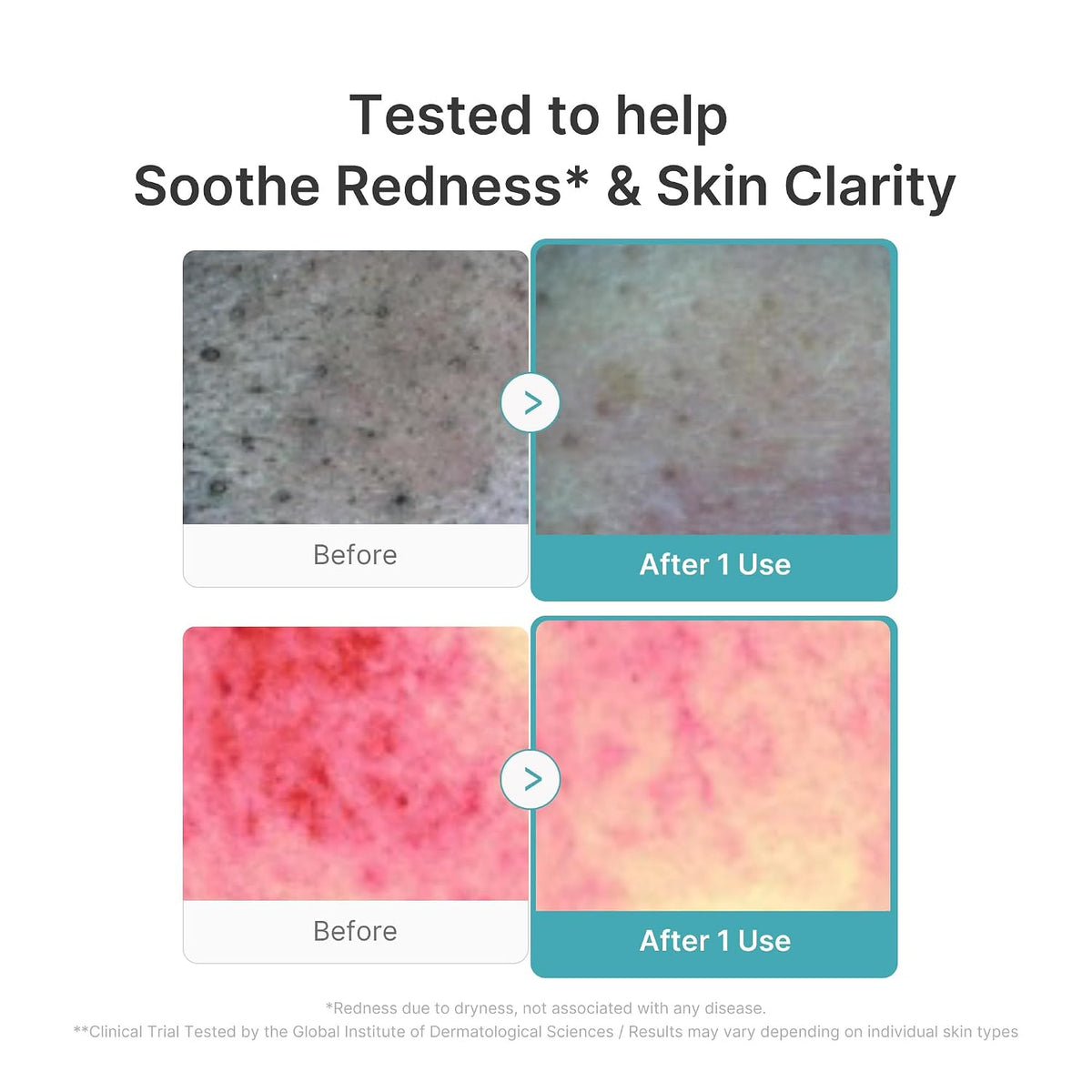 medicube Facial Cleanser Azelaic Acid Capsule Foam Cleanser