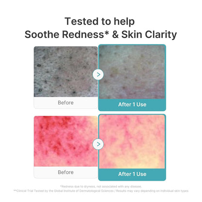 medicube Facial Cleanser Azelaic Acid Capsule Foam Cleanser