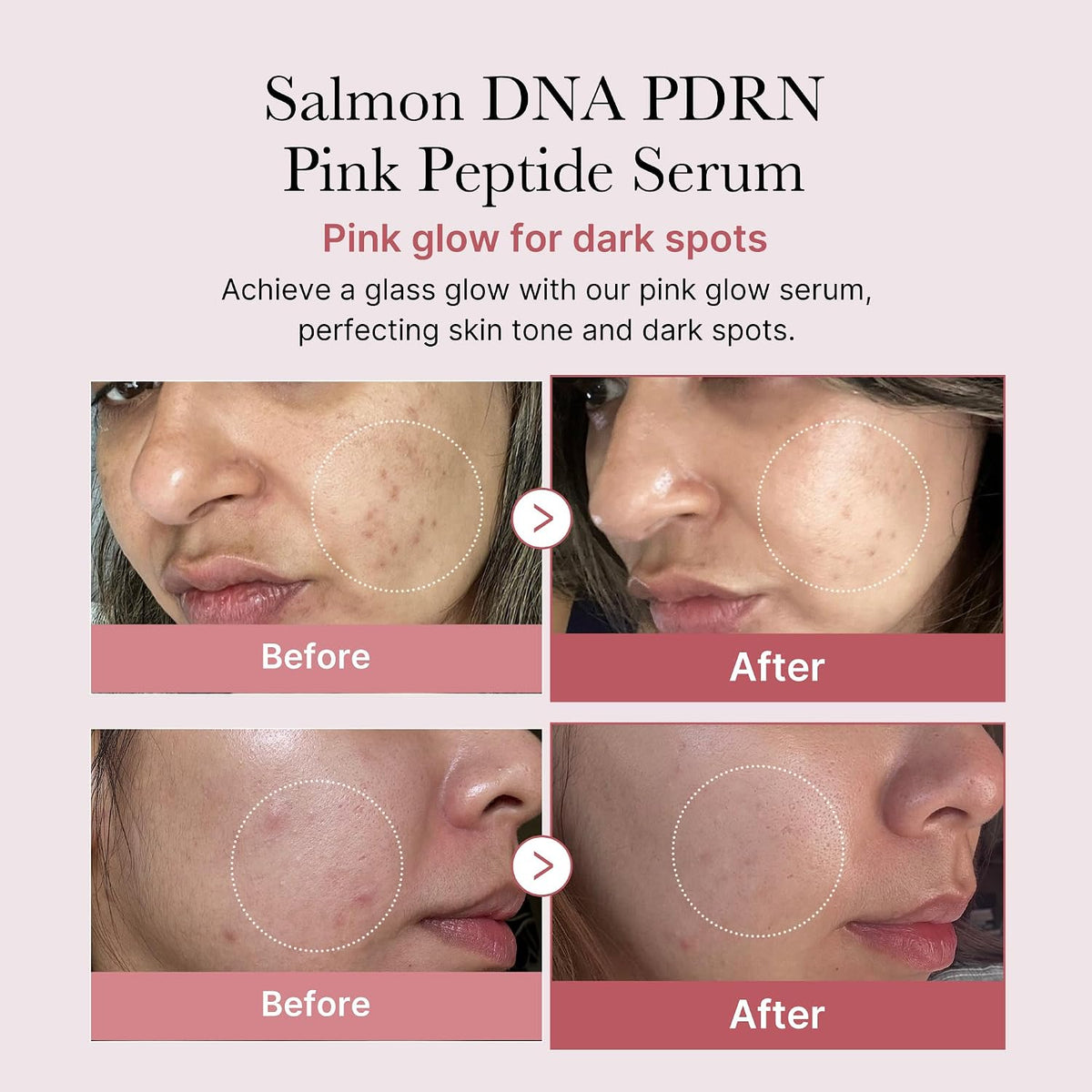 medicube For All Skin Types Duo - Zero Pore Pads and PDRN Peptide Serum