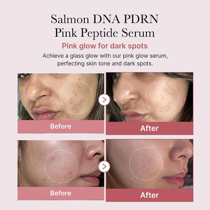 medicube For All Skin Types Duo - Zero Pore Pads and PDRN Peptide Serum