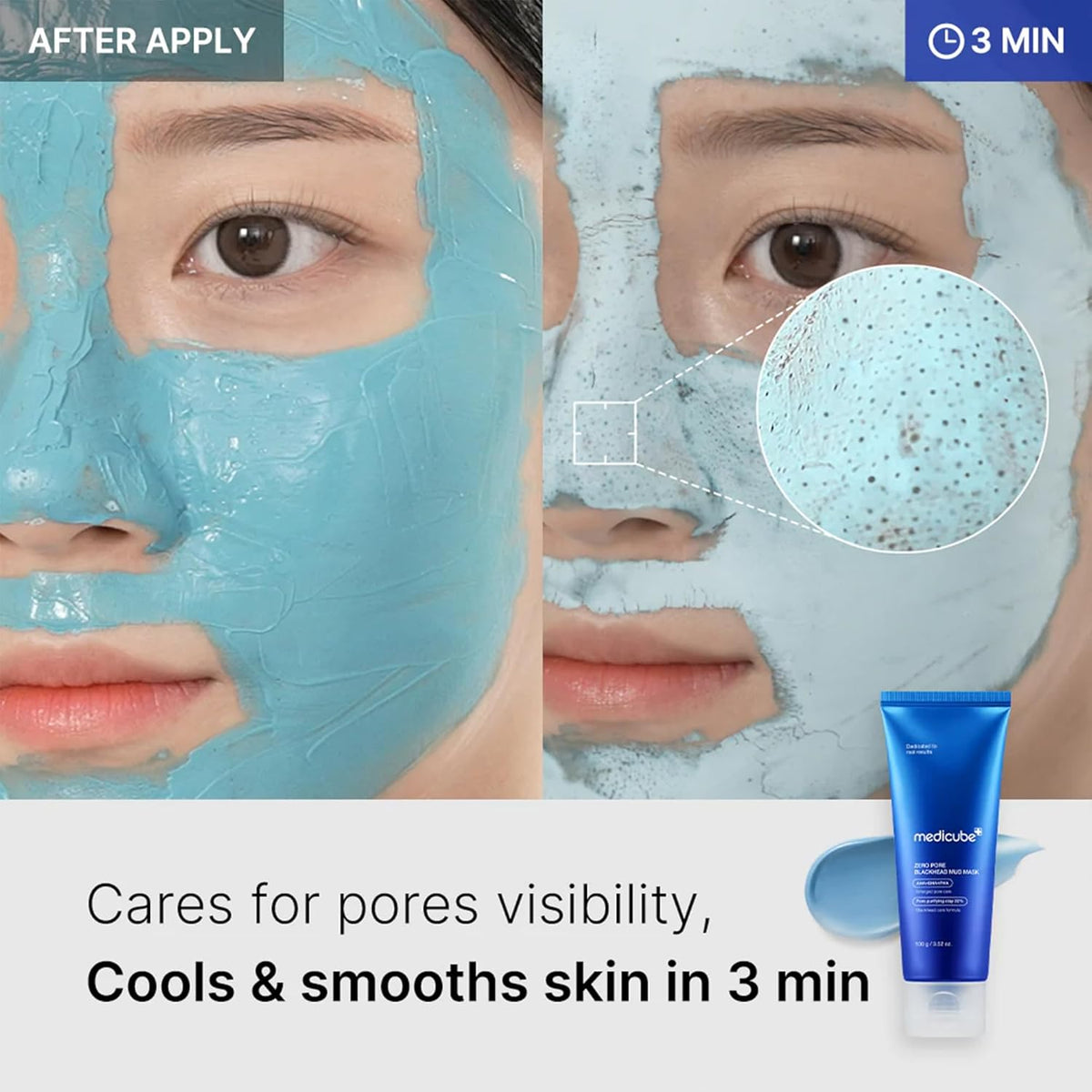 medicube All-in-One Duo - Zero Pore Pads and Zero Pore Blackhead Mud Mask
