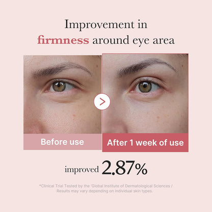 medicube Eye Serum with Salmon DNA PDRN, Peptides & Retinol for Fine Lines