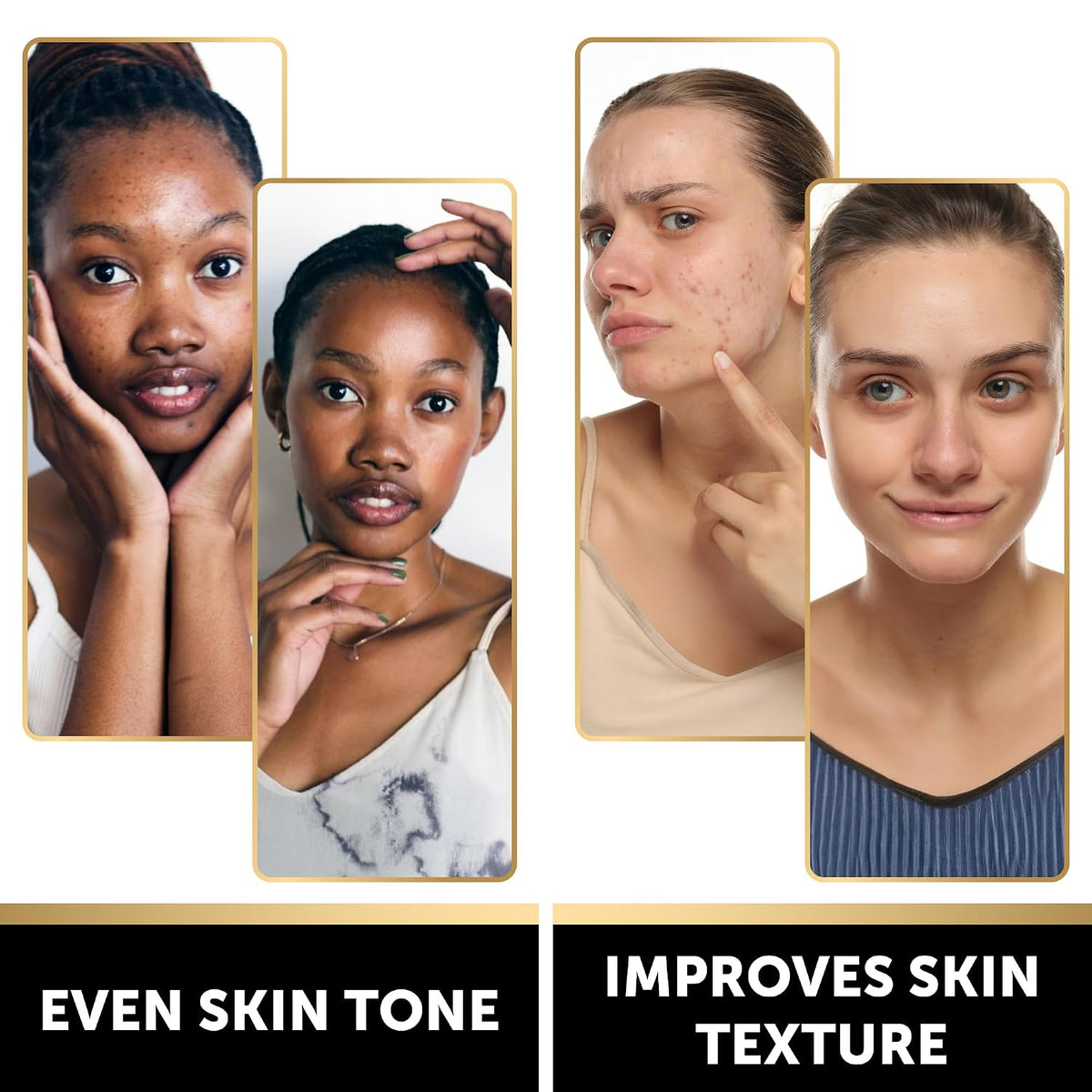 VALITIC Snail Mucin Kojic Acid Soap Bar, Anti Aging Tone Corrector 4 Pack
