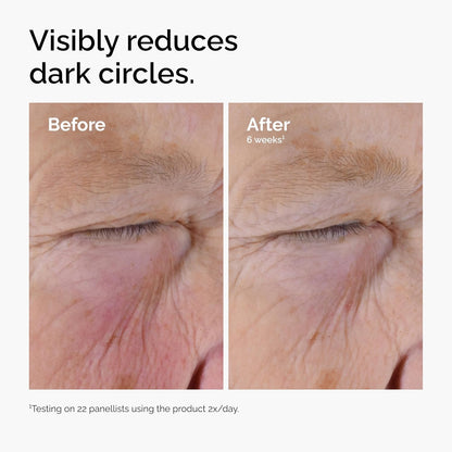 The Ordinary Caffeine Solution 5% + EGCG Eye Serum, Depuffing Eye Serum for Dark Circles and Tired Eyes (Pack of 2)