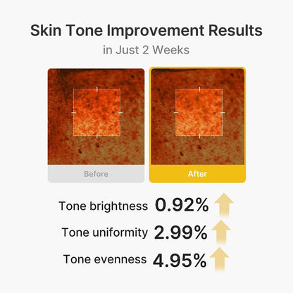 medicube Capsule Cream with Kojic Acid & Turmeric for Uneven Skin Tone