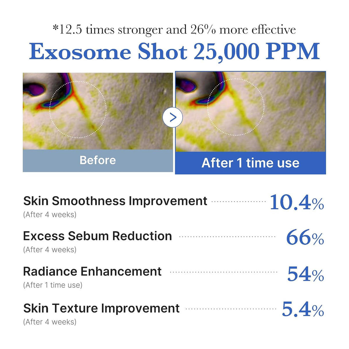medicube Exosome Shot Zero 25,000 PPM Spicule Facial Serum | Liquid Skin Booster Serum | Exosome, AHA+BHA+PHA | Pore Care, Dead Skin Cells, Skin Texture | Korean Skincare, 0.43 fl.oz (Pack of 2)