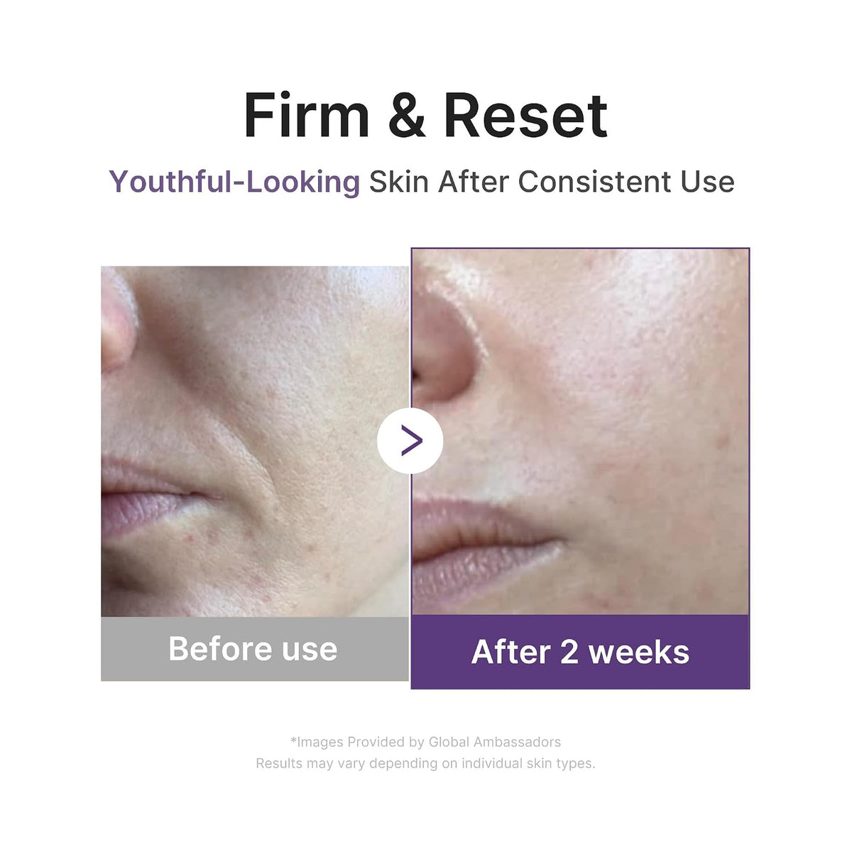 medicube Retinol & Vitamin C Radiance Duo: Retinol Boosting Serum and Deep Vita Capsule Cream | Peptides, Vitamin C Capsules for Fimer-Looking Skin, Radiance and Dull Skin | Korean Skincare