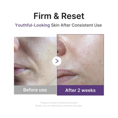 medicube Retinol & Vitamin C Radiance Duo: Retinol Boosting Serum and Deep Vita Capsule Cream | Peptides, Vitamin C Capsules for Fimer-Looking Skin, Radiance and Dull Skin | Korean Skincare