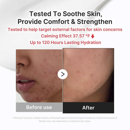 medicube Clear & Calm Skin Duo: Hypochlorous Acid Peel Shot and 3H Relief Cream | Gentle Exfoliating Serum for Dead Skin Cells and Calm with Daily Soothing Moisturizer | For Clearer, Smoother Skin