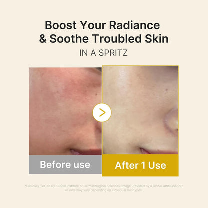 medicube Jelly Mist Serum with Kojic Acid Turmeric, Brightening Face Mist