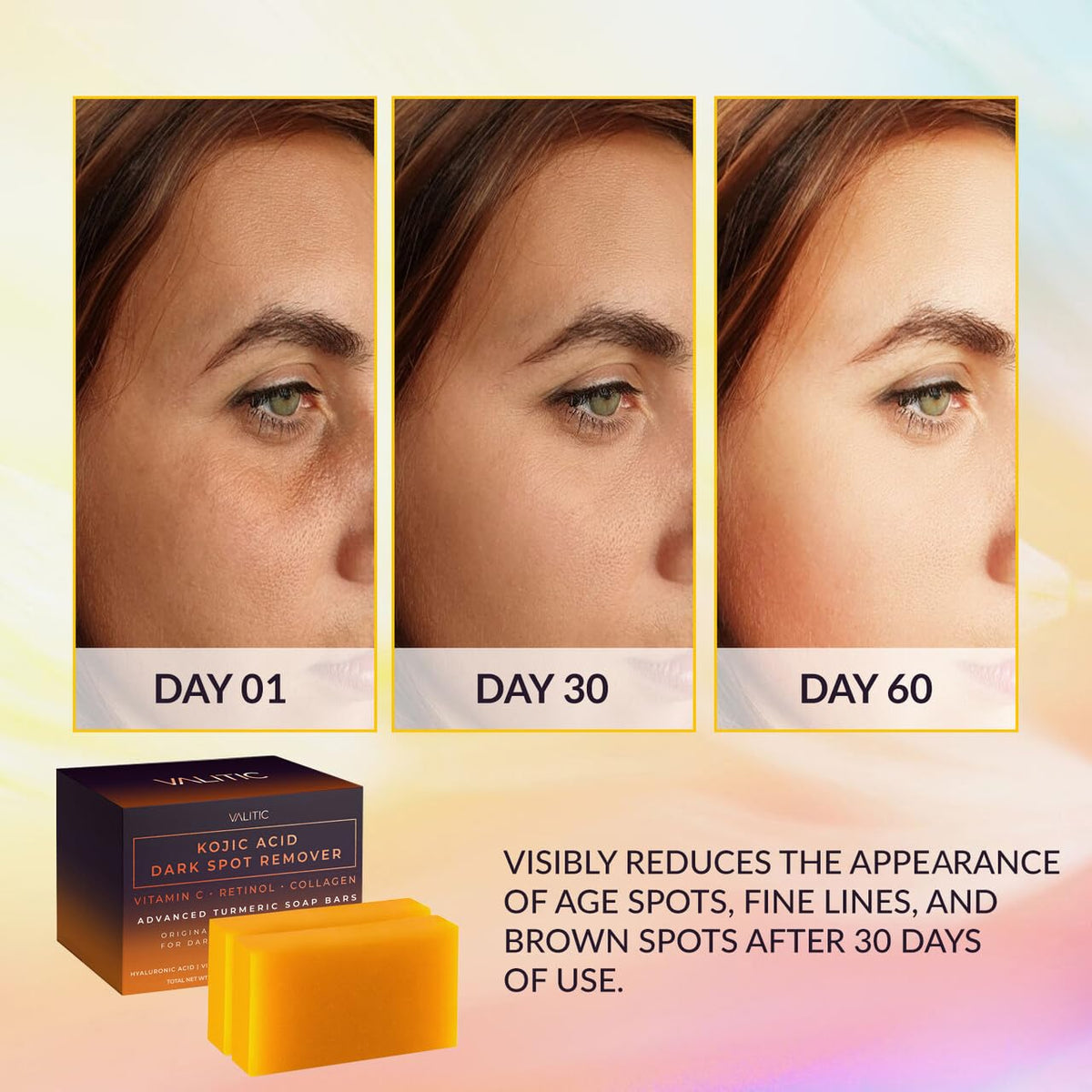 VALITIC Kojic Acid Dark Spot Remover Soap Bars, Turmeric Bar Soaps 3 Pack