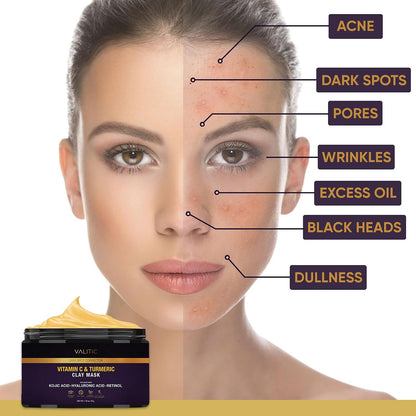 VALITIC Turmeric Vitamin C Clay Mask, Face Dark Spot Remover 50g 1.76oz