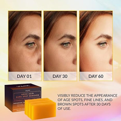 VALITIC Kojic Acid Dark Spot Remover Soap Bars, Turmeric Bar Soaps 4 Pack