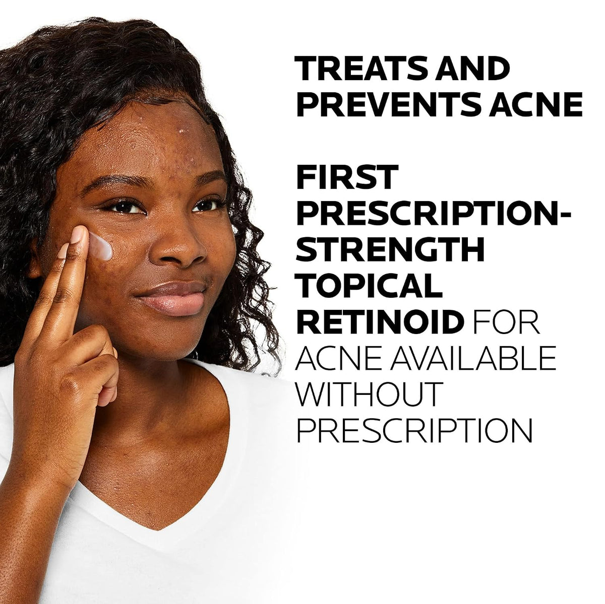 La Roche-Posay Effaclar Adapalene Gel 0.1% Acne Treatment, 1.6oz