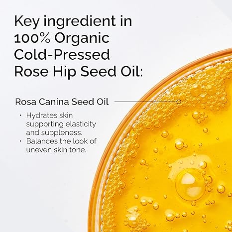 The Ordinary 100% Organic Cold-Pressed Rose Hip Seed Oil, Addresses Signs of Aging by Improving the Appearance of Uneven Skin Tone, Supporting Skin Elasticity, 1 Fl Oz