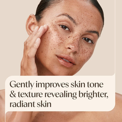 Aveeno Positively Radiant Clear Complexion Acne Face Moisturizer, 4 fl. oz