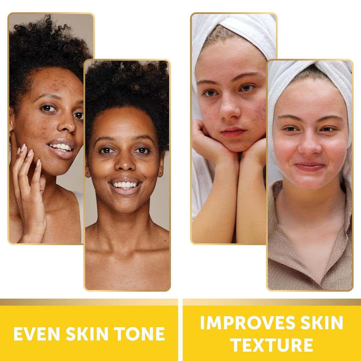 VALITIC Turmeric and Kojic Acid Cleansing Pads for Dark Spots 60 Units